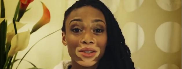 Maquillage vitiligo & taches pigmentées La Roche Posay